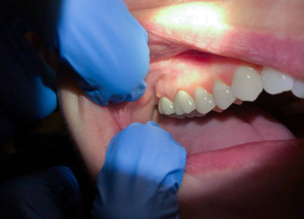 Best Broken Tooth Emergency  in Macom, IL