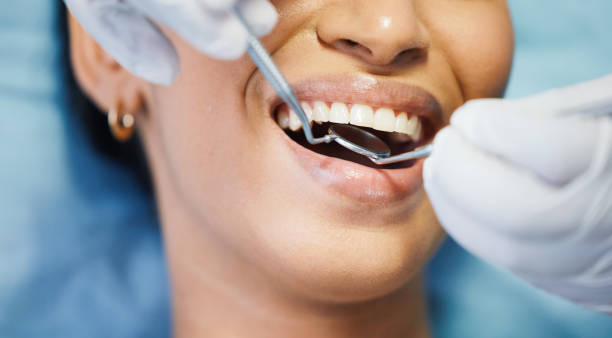 Best Same-Day Dentist Appointment  in Macom, IL