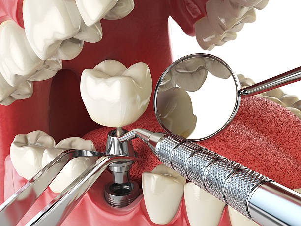 Best Emergency Gum Pain Relief  in Macom, IL
