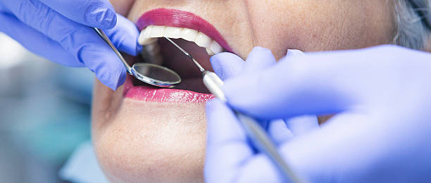 Best Emergency Dental Filling Replacement  in Macom, IL